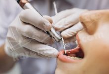 تفسير حلم ظهور أسنان فوق اسناني للعزباء