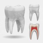 تفسير حلم الأسنان الملونة