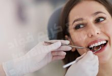ما معنى ان تسقط الاسنان في المنام